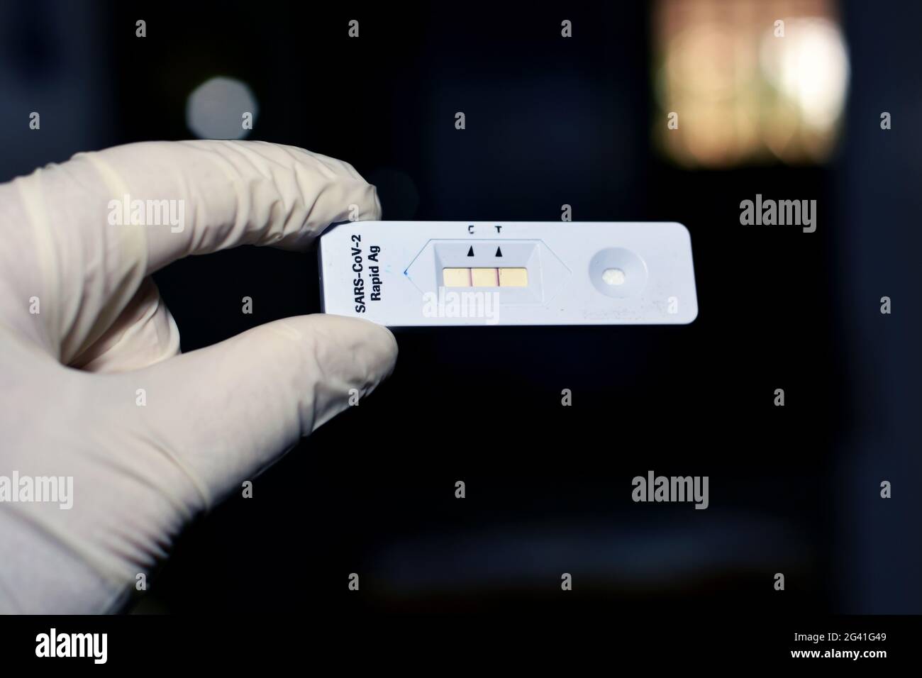 Un personale medico mostra un risultato positivo del test di SARS-COV-2 Rapid AG, test positivo del virus della corona di Covid-19 su sfondo sfocato, nuova pandemia c Foto Stock