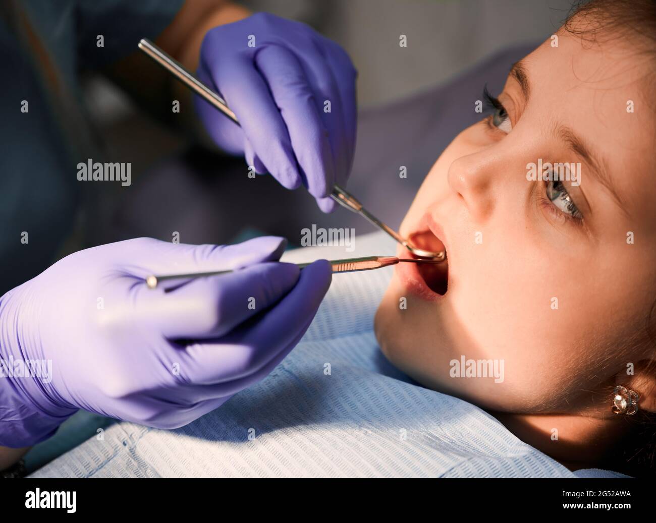 Primo piano del dentista in guanti sterili che esamina i denti del bambino con l'esploratore dentale e lo specchio. Concetto di odontoiatria pediatrica e cura dentale. Foto Stock