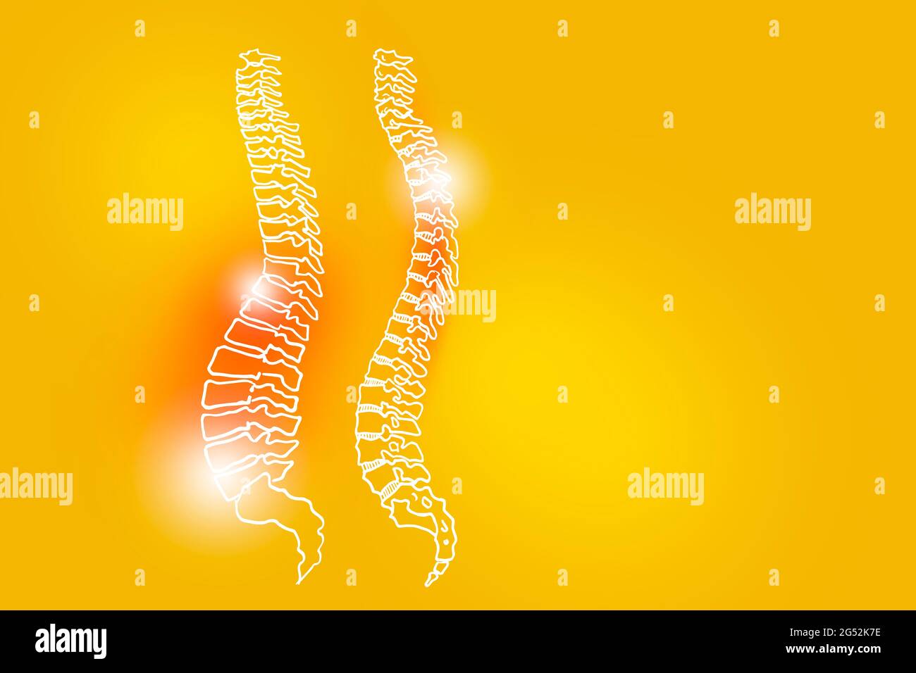Illustrazione Handrawn della colonna vertebrale umana su sfondo giallo. Set medico-scientifico con i principali organi umani con spazio di copia vuoto per testo o infografica. Foto Stock
