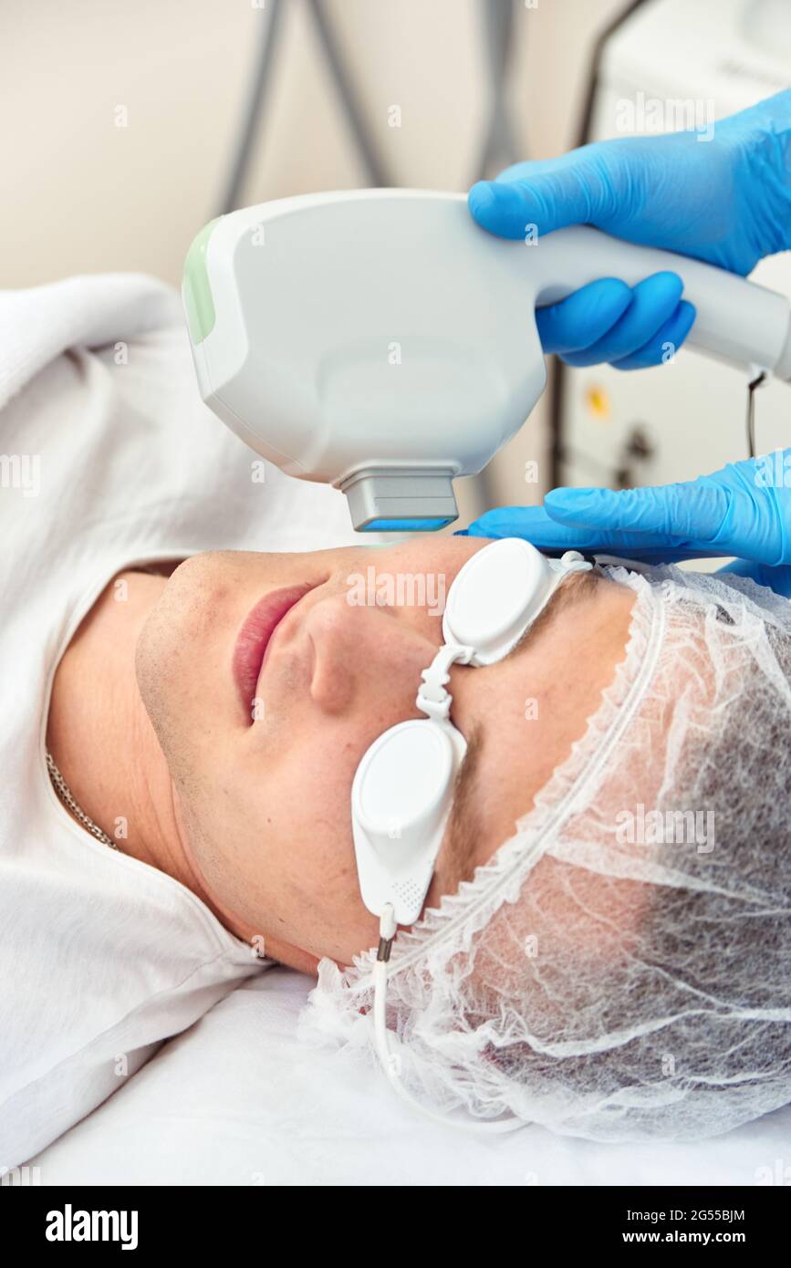 la terapia facciale laser per l'uomo. gli occhi sono protetti da occhiali  speciali Foto stock - Alamy