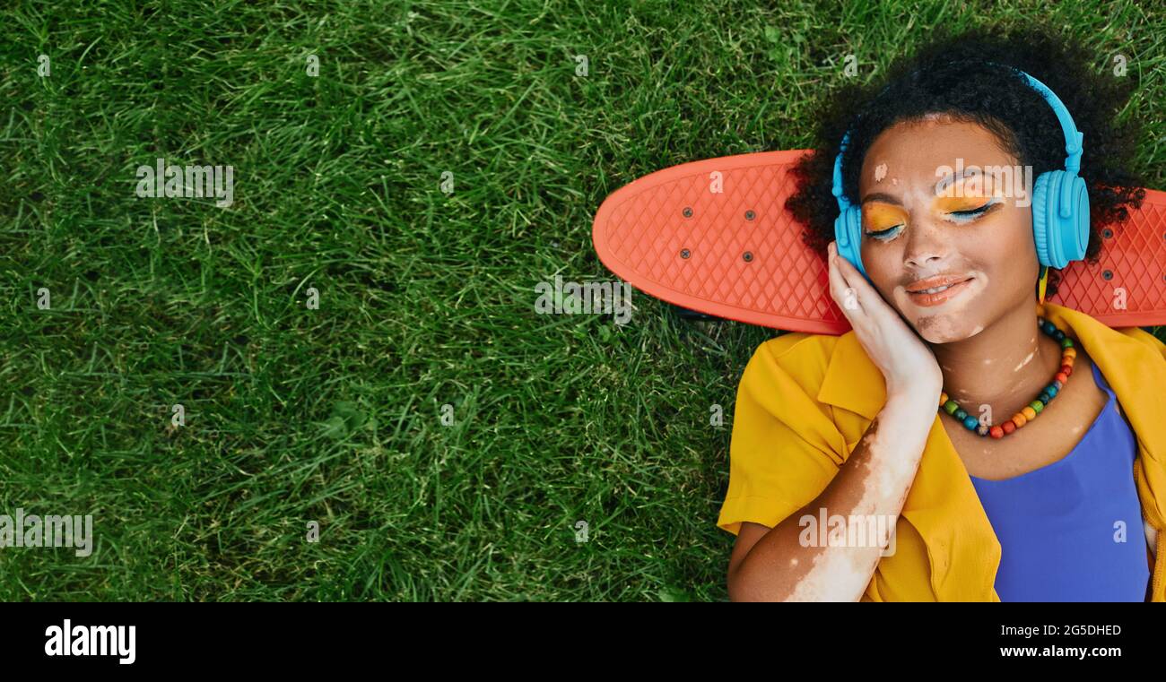 Donna mista da corsa con vitiligo che indossa cuffie blu ascolta la musica sdraiata sull'erba vicino a skateboard e sogni con occhi chiusi Foto Stock
