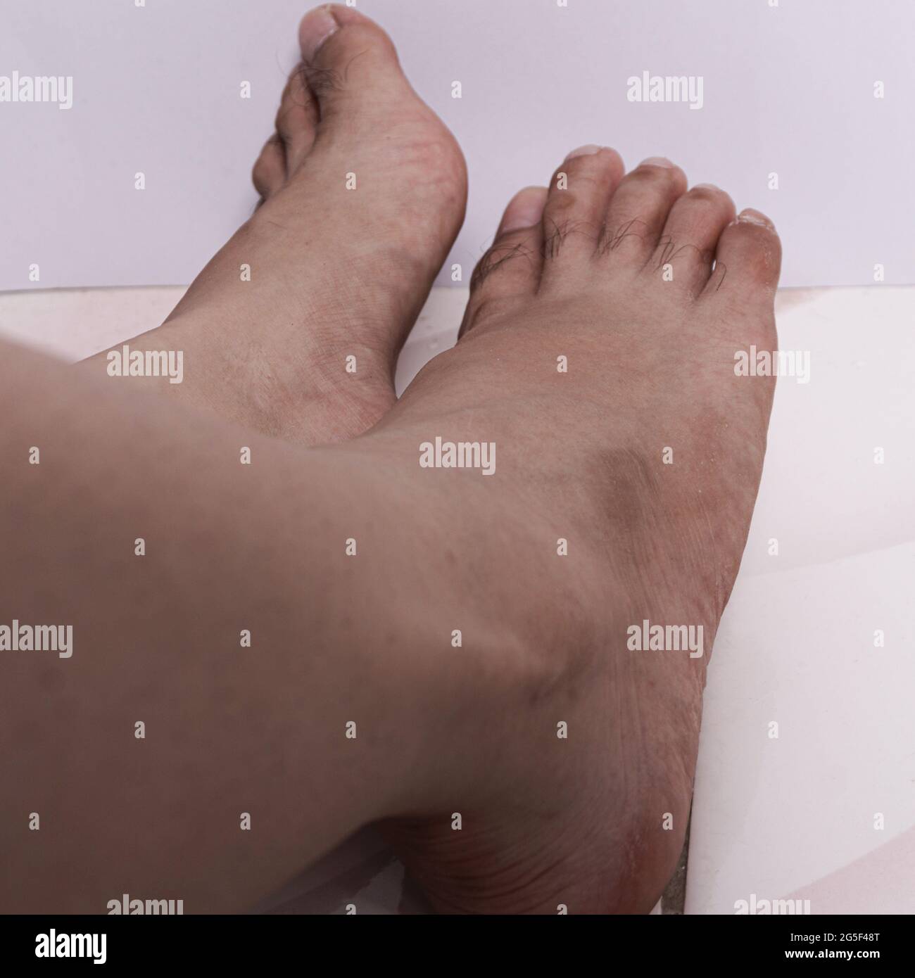 Closeup di donna a piedi nudi con punte dolorose. Scarpe con tacco alto,  dolore e calli Foto stock - Alamy