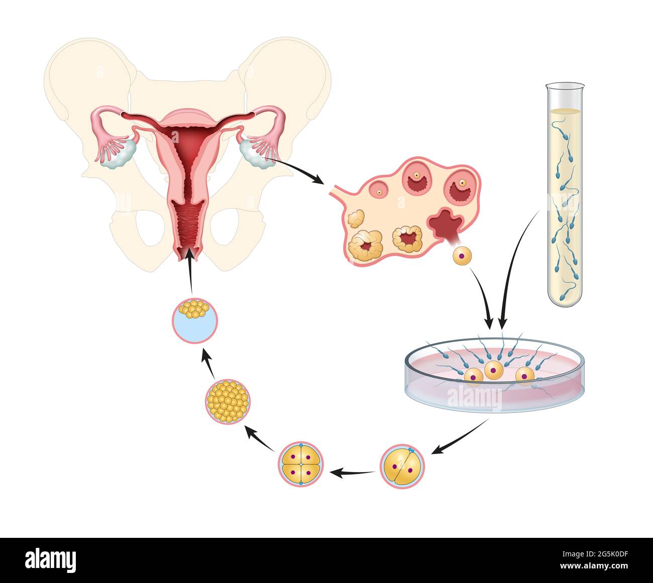 Inseminazione artificiale. Fertilizzazione in vitro. Illustrazione Foto Stock