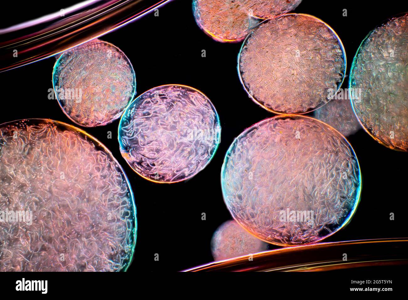 Gelatina stellare (spec. Nostoc), immagine microscopio a campo luminoso, ingrandimento x160 relativo ad una stampa di 10 cm di larghezza, Germania Foto Stock