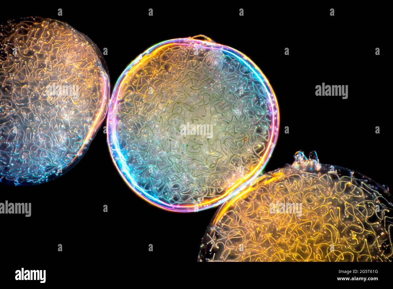 Gelatina stellare (spec. Nostoc), immagine microscopio a campo luminoso, ingrandimento x160 relativo ad una stampa di 10 cm di larghezza, Germania Foto Stock