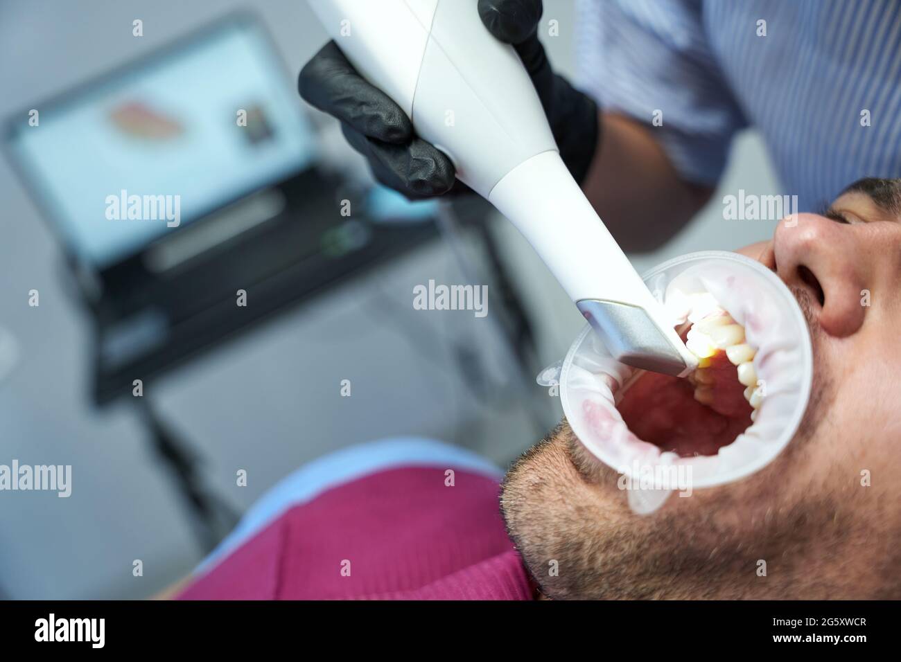 Giovane uomo che ha un trattamento dentistico laser in clinica Foto Stock