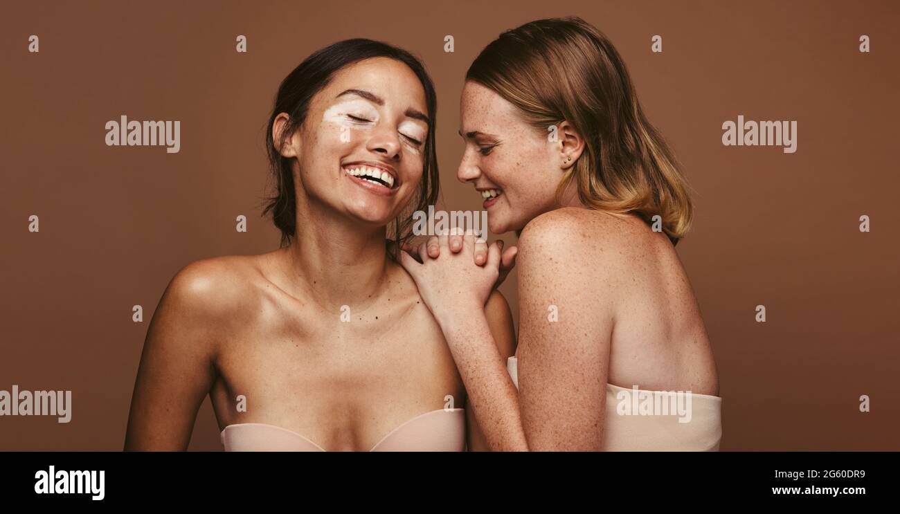 Due giovani donne con la pelle in piedi insieme su sfondo marrone. Donna con pelle diversa che accetta la loro bellezza naturale. Foto Stock