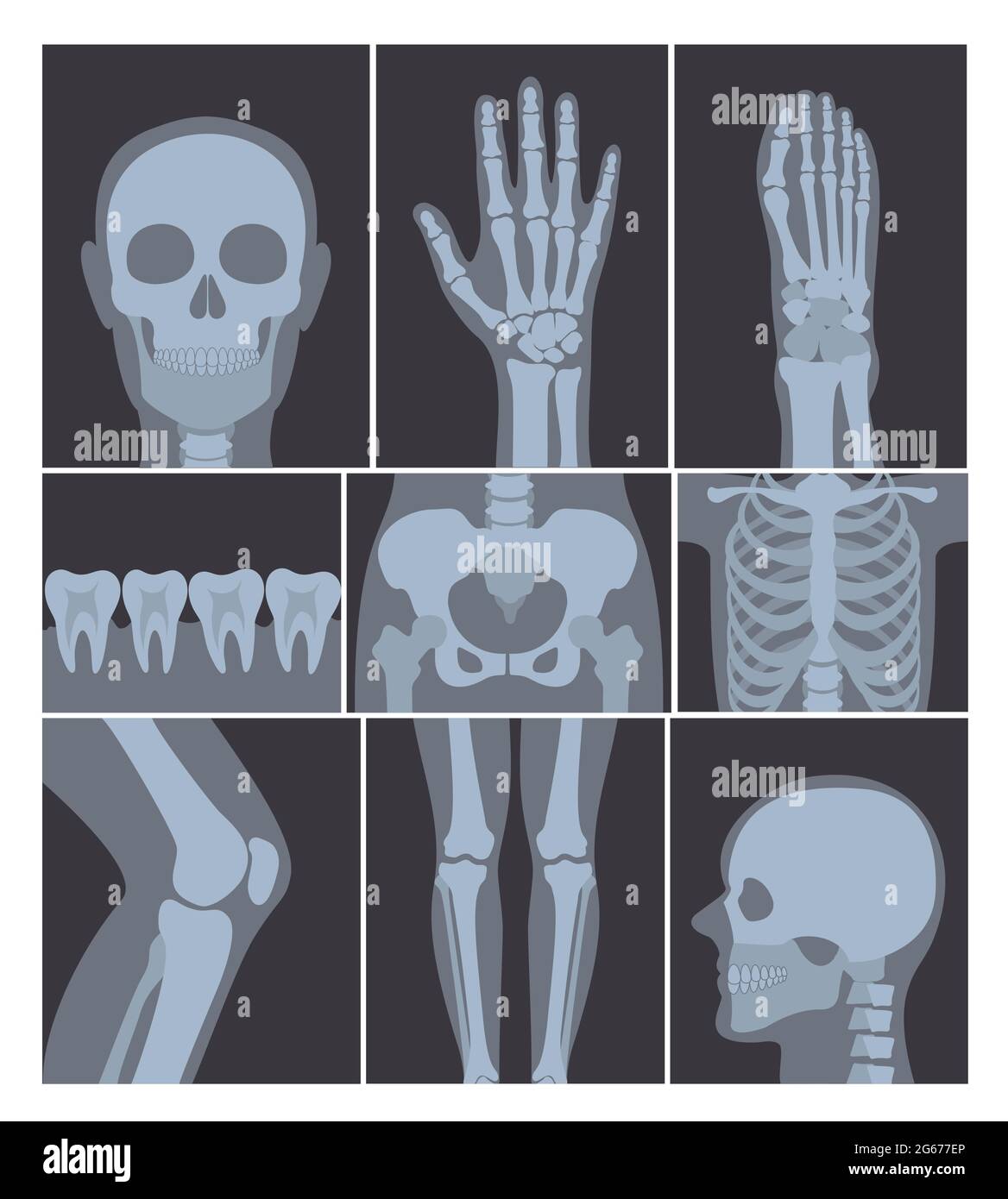 Illustrazione vettoriale Set di shot a raggi X. Mano, testa, ginocchio e altre parti del corpo umano su radiografie su sfondo bianco. Illustrazione Vettoriale