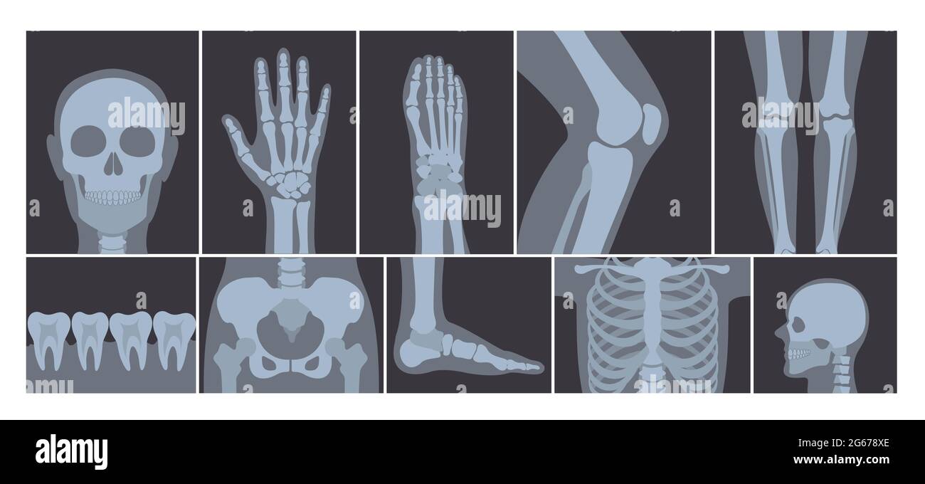 Illustrazione vettoriale di serie realistica di molte immagini a raggi X del corpo umano. Foto radiografiche trasparenti su sfondo bianco. Illustrazione Vettoriale