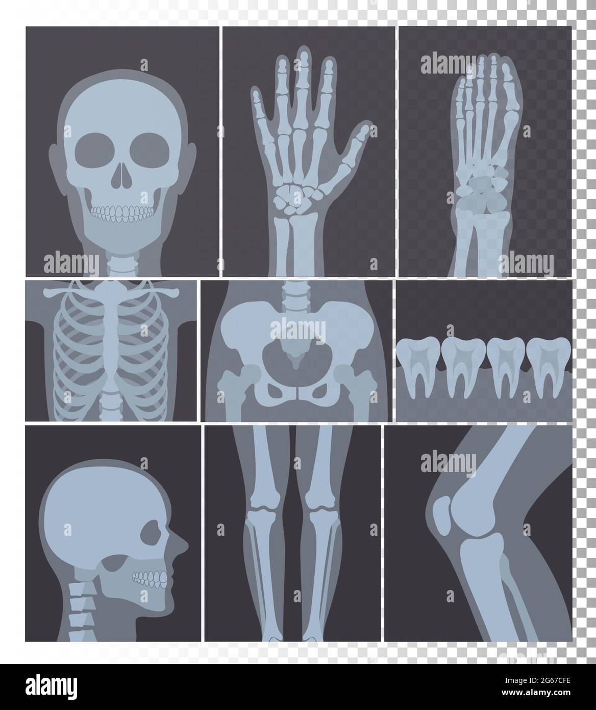 Illustrazione vettoriale di una raccolta realistica di shot radiologici. Immagini a raggi X di testa, ossa, denti, parti del corpo raggi X su sfondo trasparente. Illustrazione Vettoriale