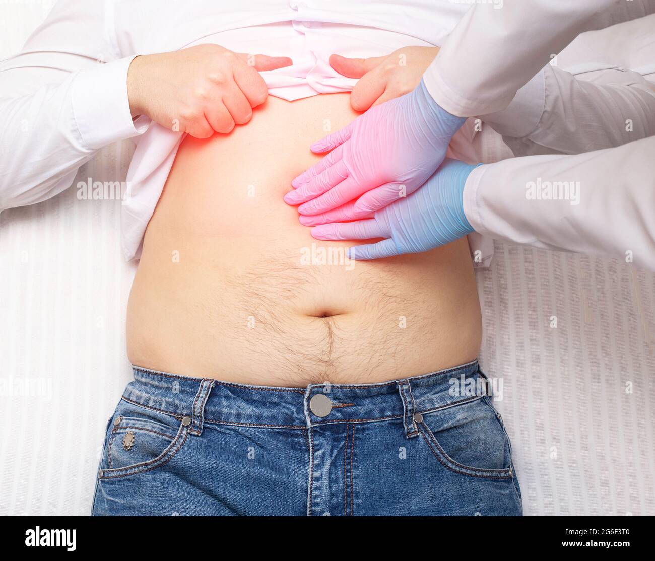 Il medico esamina un paziente che ha dolore addominale. Concetto di infiammazione del pancreas, pancreatite, primo piano. Infiammazione della cistifellea e del duodo Foto Stock