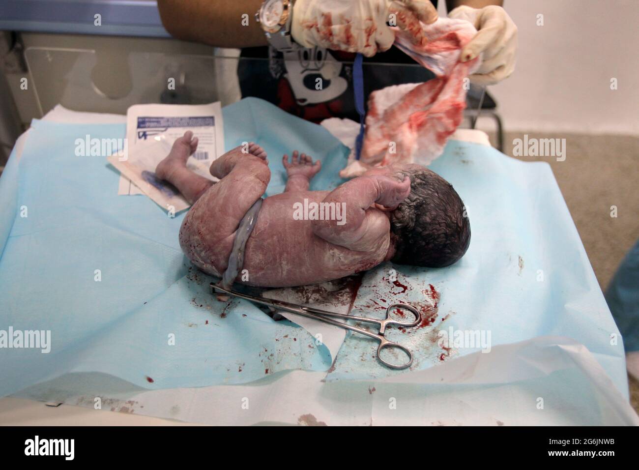 Maracaibo- Venezuela-19-06-2015- Maternity Castillo Plaza in Venezuela. Un bambino parto dal neonato nel reparto di travaglio. © JOSE ISAAC BULA URRUTIA / Alamy St Foto Stock
