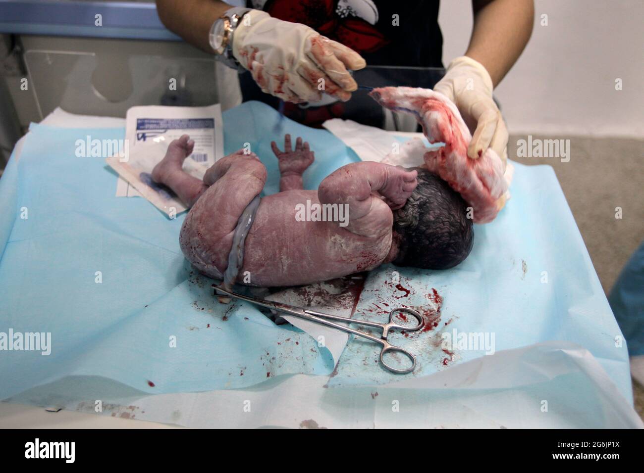 Maracaibo- Venezuela-19-06-2015- maternità Castillo Plaza in Venezuela. Un parto ragazzo da neonato in reparto di lavoro. © JOSE ISAAC BULA URRUTIA / ALAMY S Foto Stock