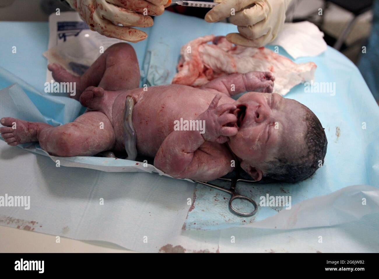 Maracaibo- Venezuela-19-06-2015- Maternity Castillo Plaza in Venezuela. un parto di un ragazzo da neonato controllato dal ginecologo. © JOSE ISAAC BULA Foto Stock