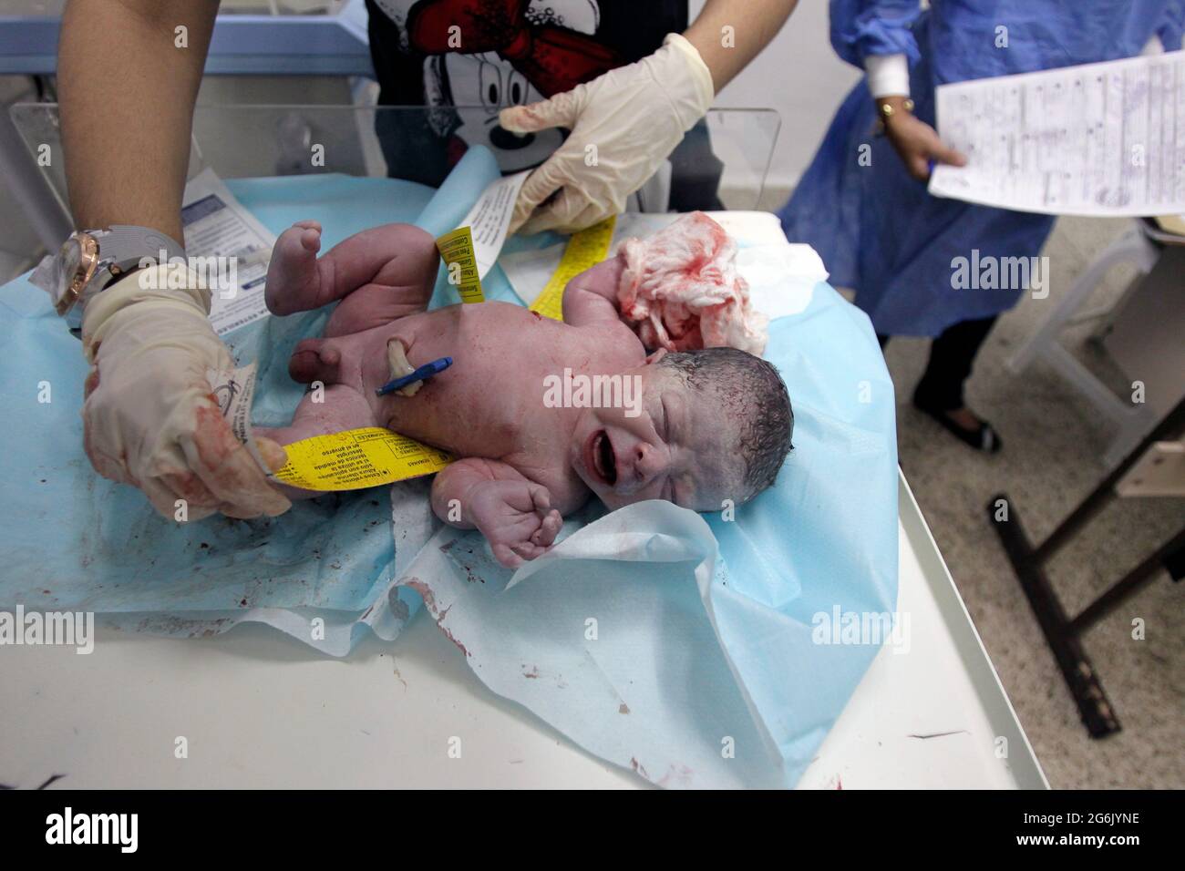 Maracaibo- Venezuela-19-06-2015- Maternity Castillo Plaza in Venezuela. Il parto di un bambino da neonato viene controllato con un nastro di misurazione. © JOSÉ Foto Stock