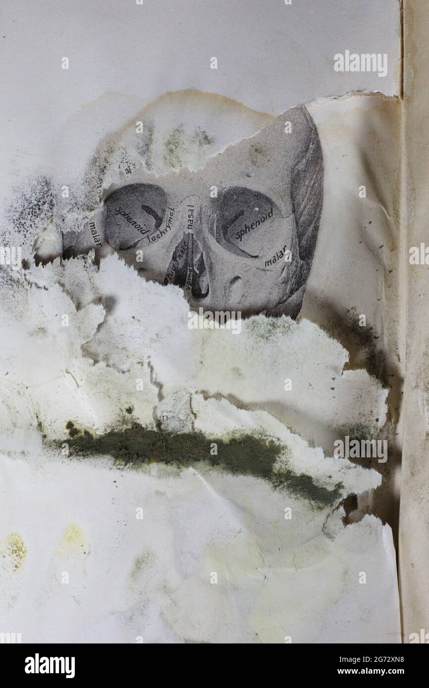 Un'illustrazione vintage di un cranio sotto strati di muffa in un vecchio manuale medico. Foto Stock