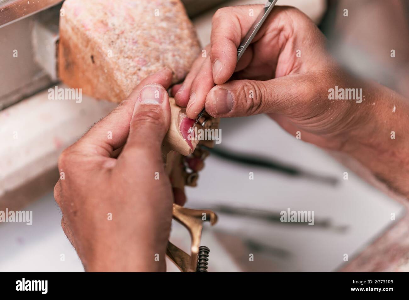 Particolare delle mani di un dentista che fissa una protesi dentale Foto Stock