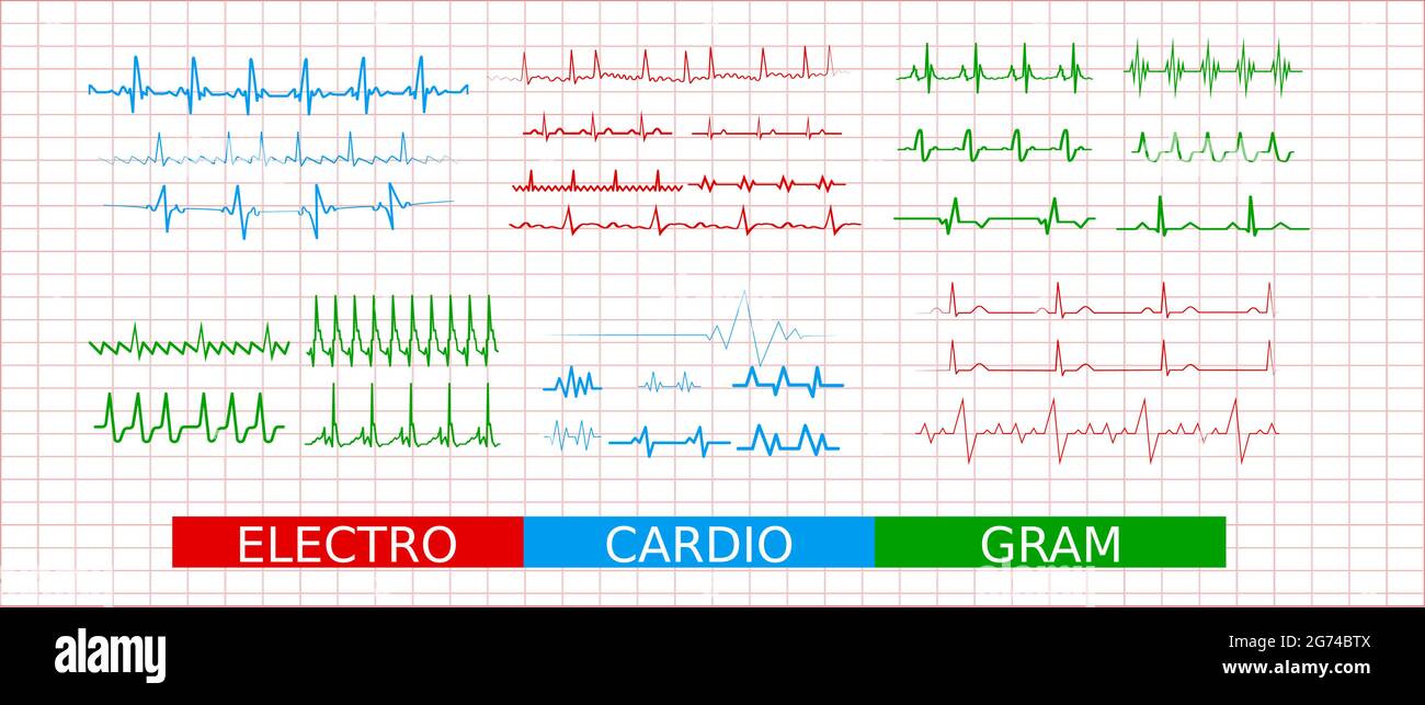 Linea del battito cardiaco dell'elettrocardiogramma, raccolta di icone delle linee del cardiogramma. Set di cartelli per infografica, logo, sviluppo di app, web design. Illustrazione Vettoriale