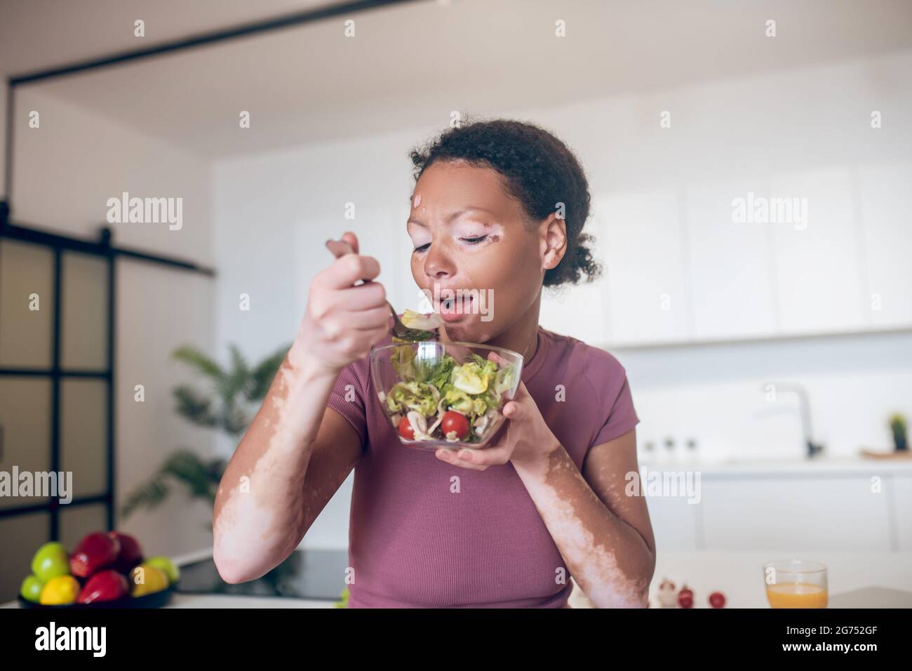 Una giovane donna con pigmentazione sul viso mangiare insalata Foto Stock