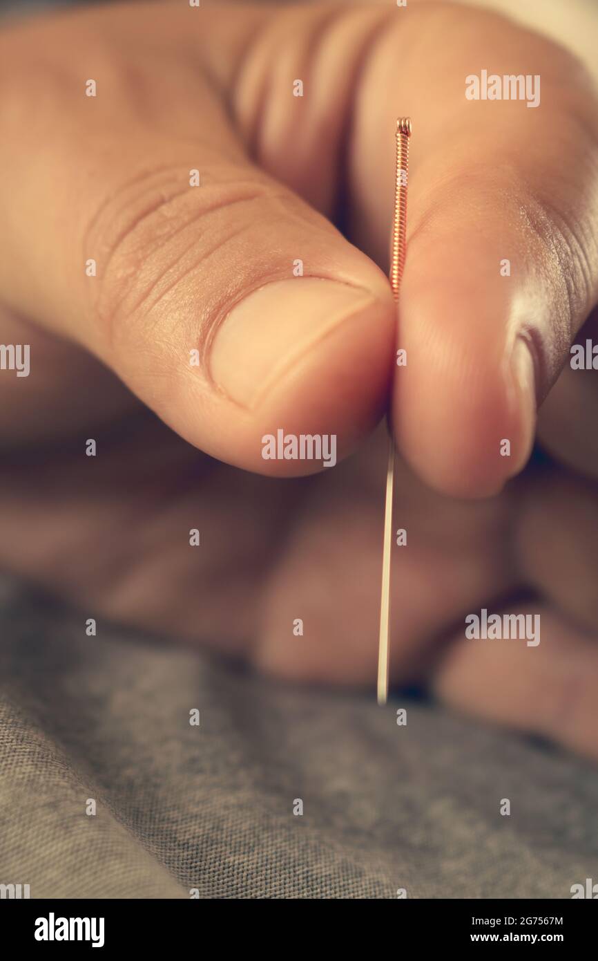 Mani di un medico che tiene un ago di agopuntura maneggiato di rame. Medicina alternativa cinese. Trattamento di malattie con aghi. Foto Stock
