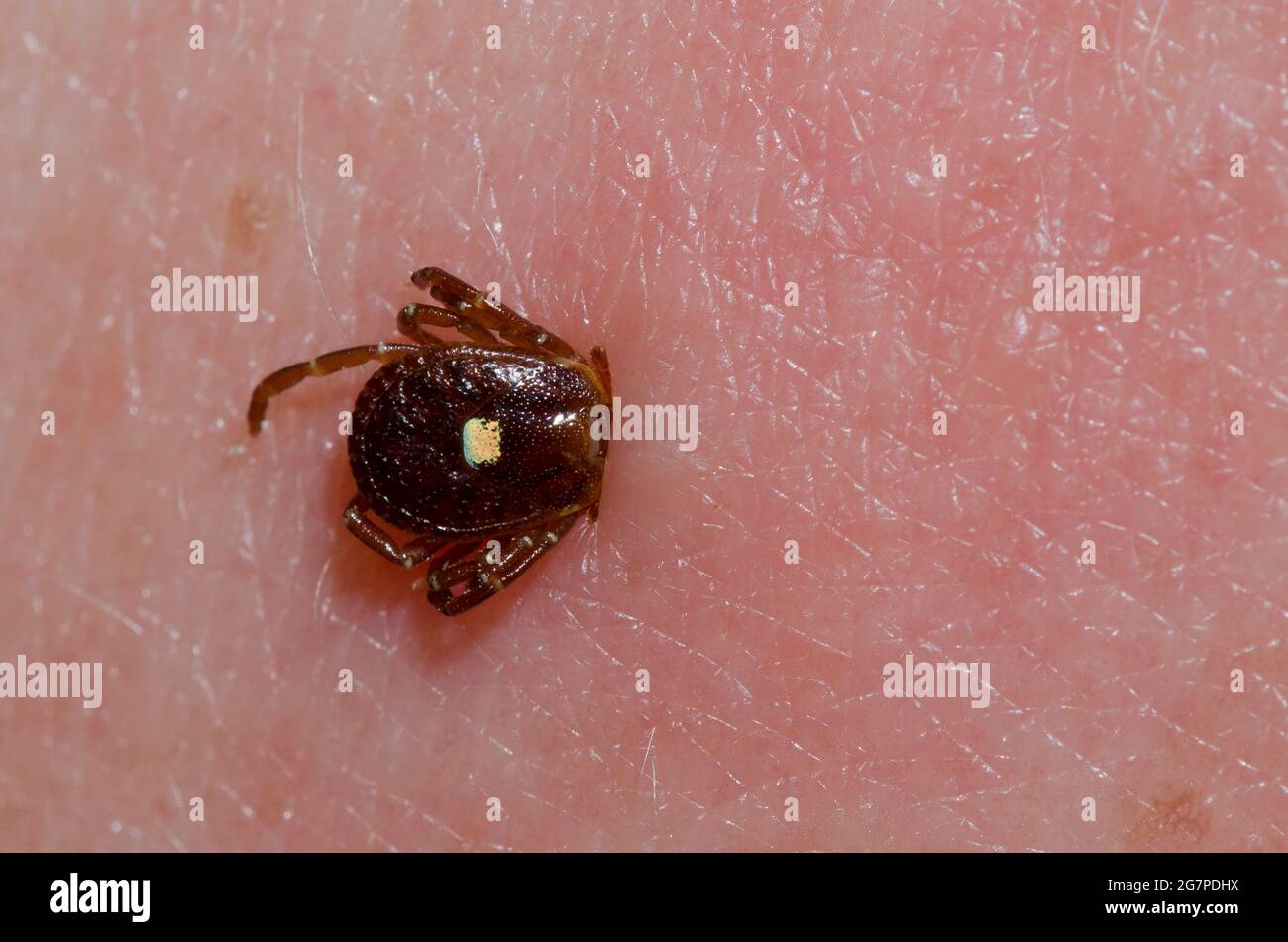 Lone Star Tick, Amblyomma americanum, femmina attaccata alla pelle umana Foto Stock