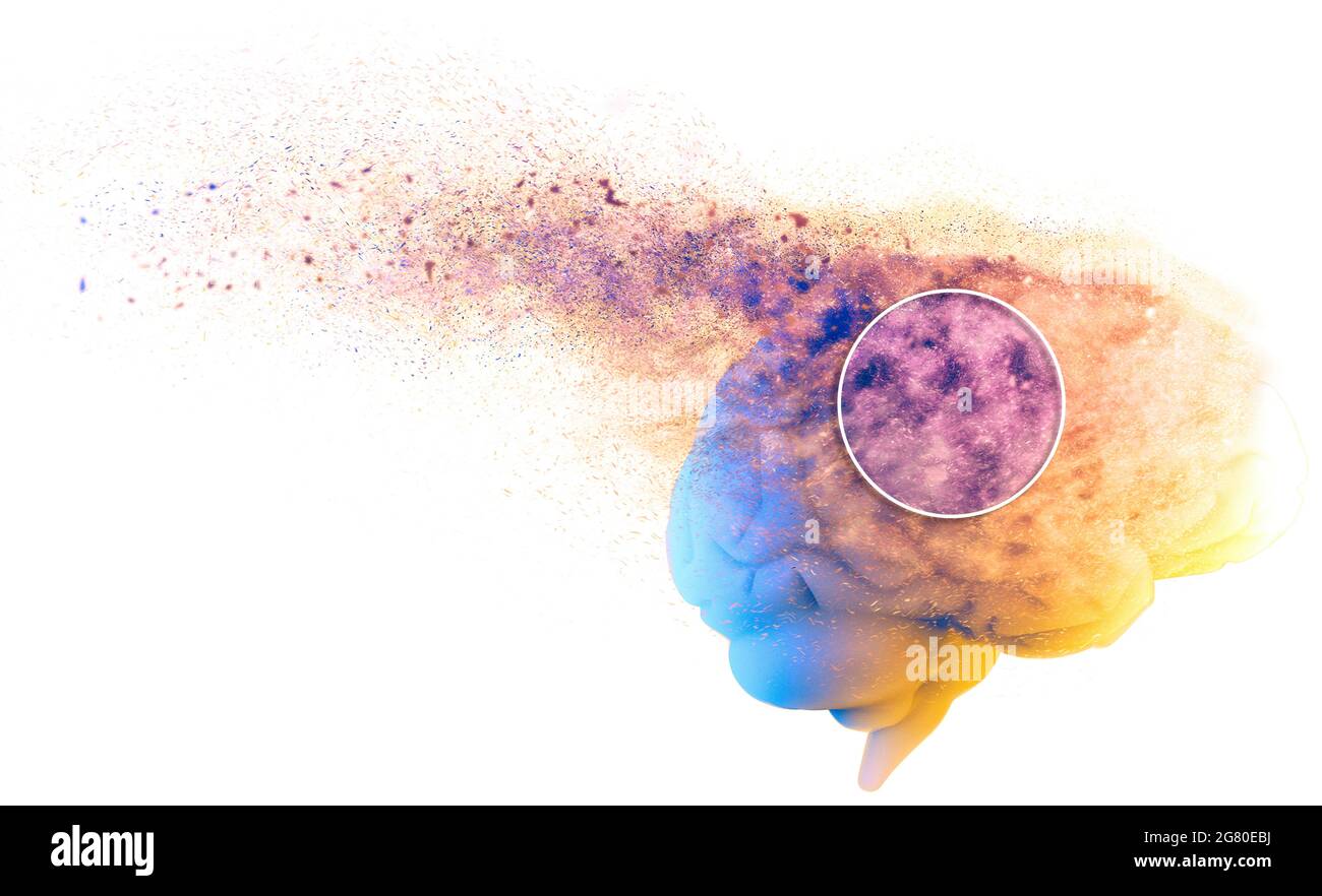 Callas Malattia Degenerativa La memoria decade, dimentica le cose, malattia degenerativa. Problemi