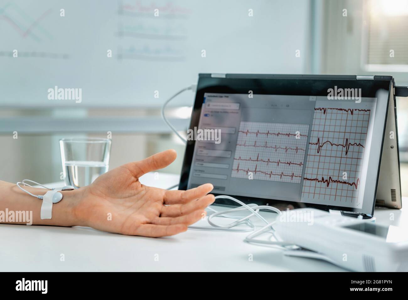 Mano con sensori per la misurazione della frequenza cardiaca Foto Stock