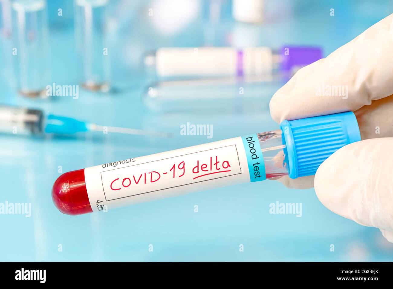 Medico con un campione di sangue positivo per la nuova variante rilevata del ceppo di coronavirus chiamato COVID DELTA. Ricerca di nuovi ceppi e mutazioni o Foto Stock