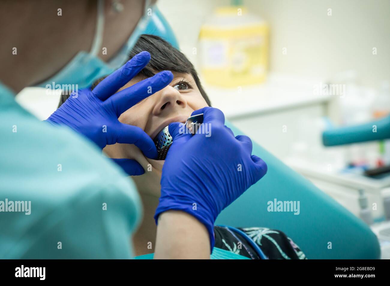 Ragazzo caucasico con capelli marroni presso l'ufficio del dentista mettendo uno stampo di alginato per impressioni dentali Foto Stock