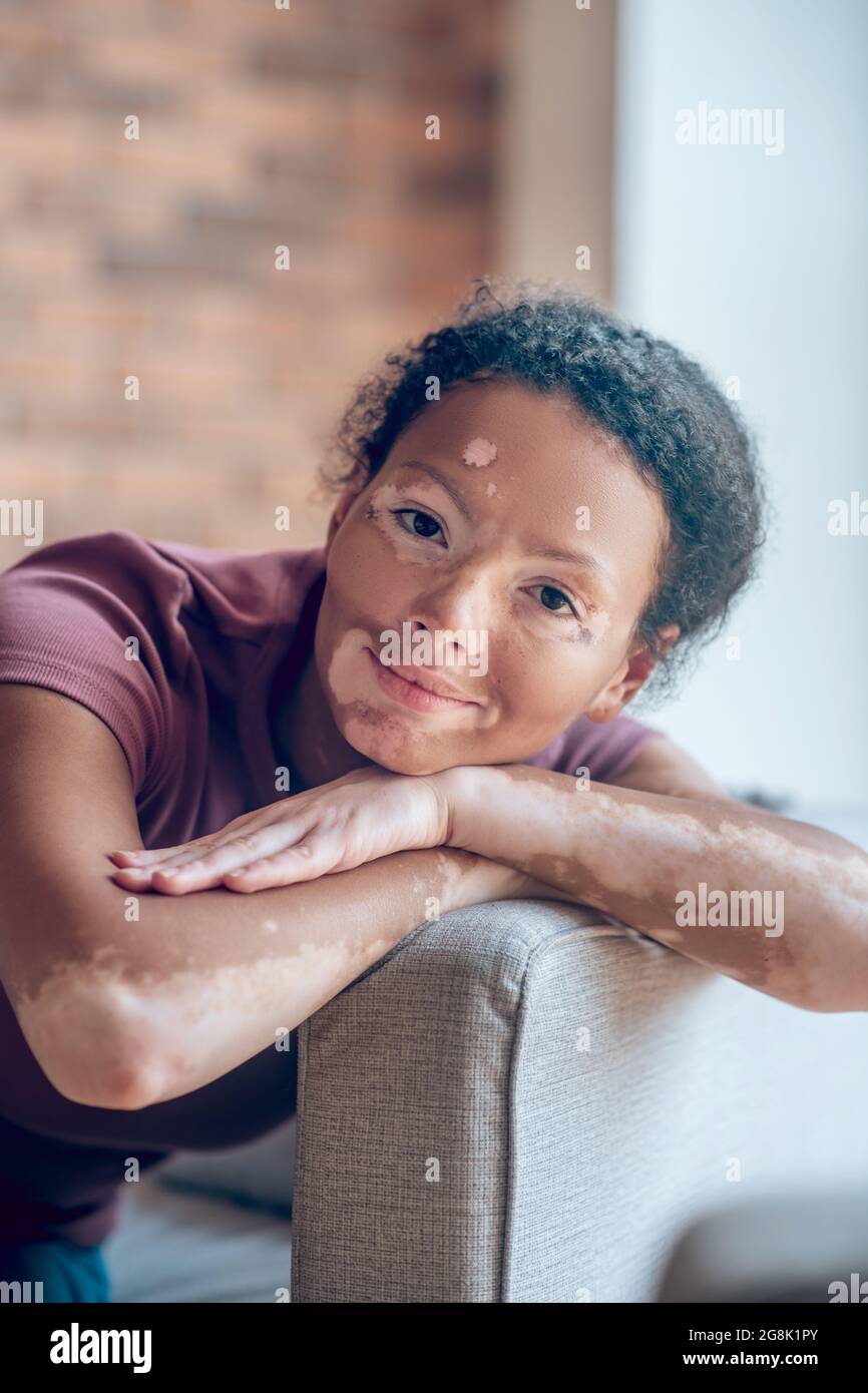 Carina giovane donna con pigmentazione sul viso che guarda candide e dolce Foto Stock