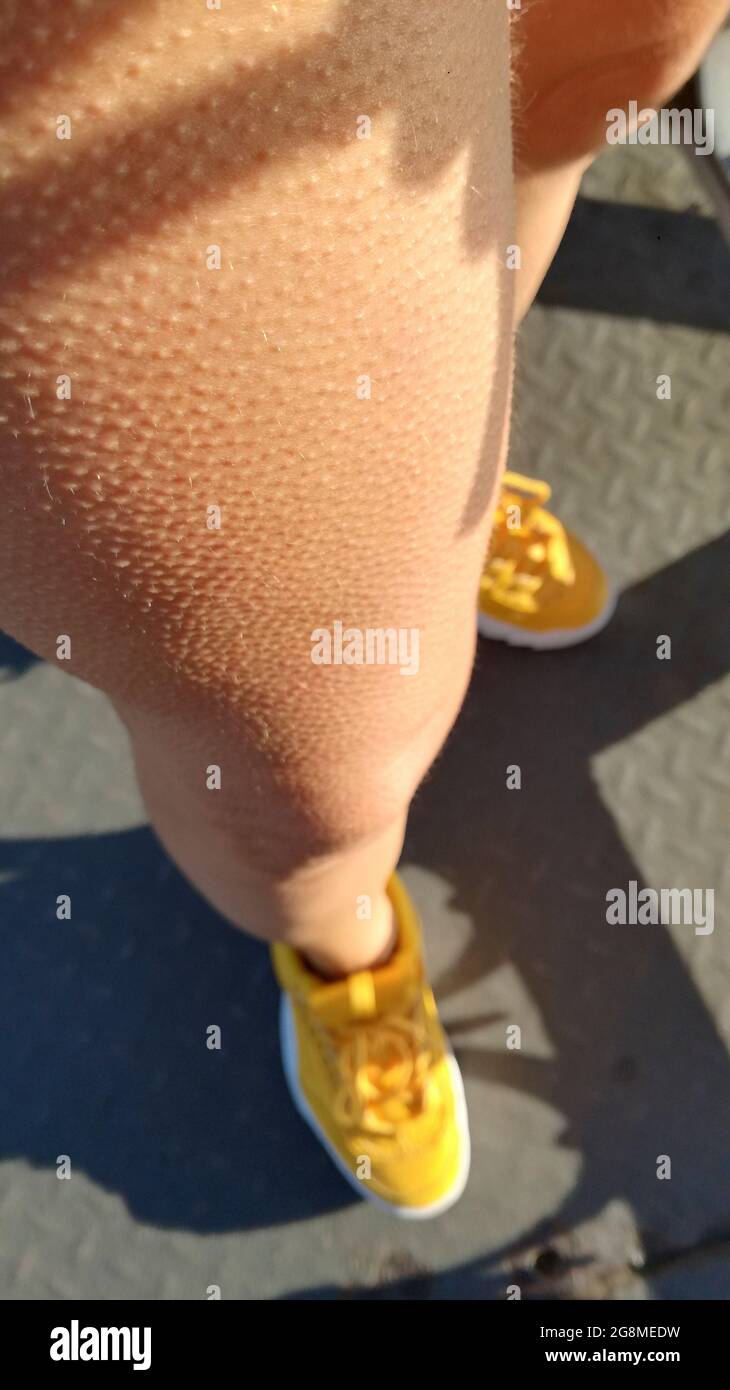 dettagli delle gambe con urti in oca a basse temperature Foto Stock