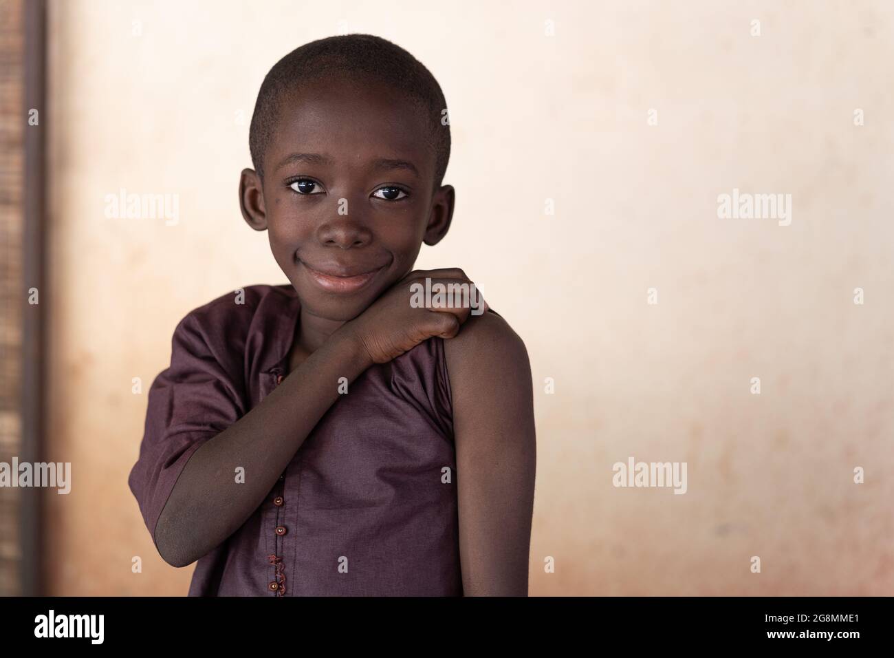 Il ragazzo africano mostra la spalla, pronto ad essere vaccinato. Qual è la tua scusa? Foto Stock