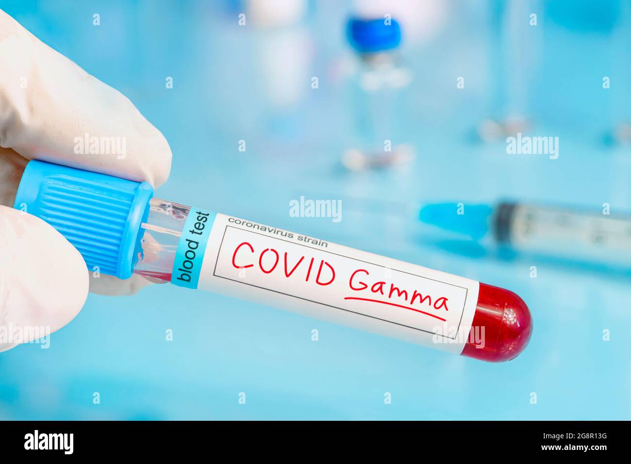 Medico con un campione di sangue positivo per la nuova variante rilevata del ceppo di coronavirus chiamato covid 19 gamma. Ricerca di nuovi ceppi e mutazioni Foto Stock