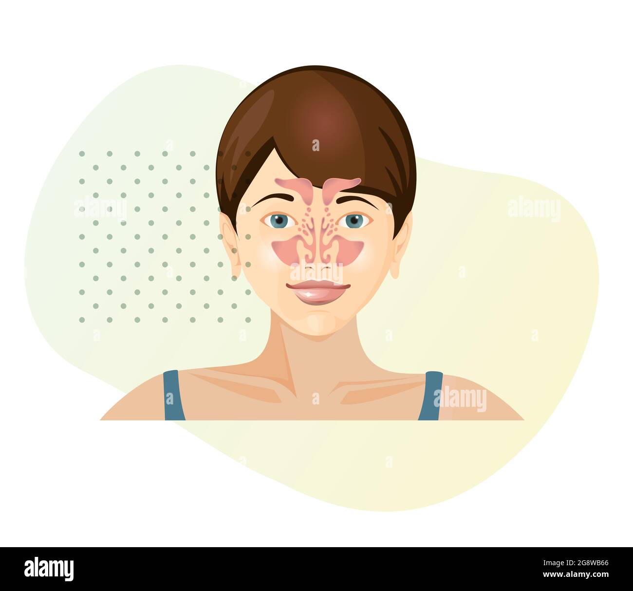 Anatomy del naso - sinusitis - illustrazione di magazzino come EPS 10 file Illustrazione Vettoriale