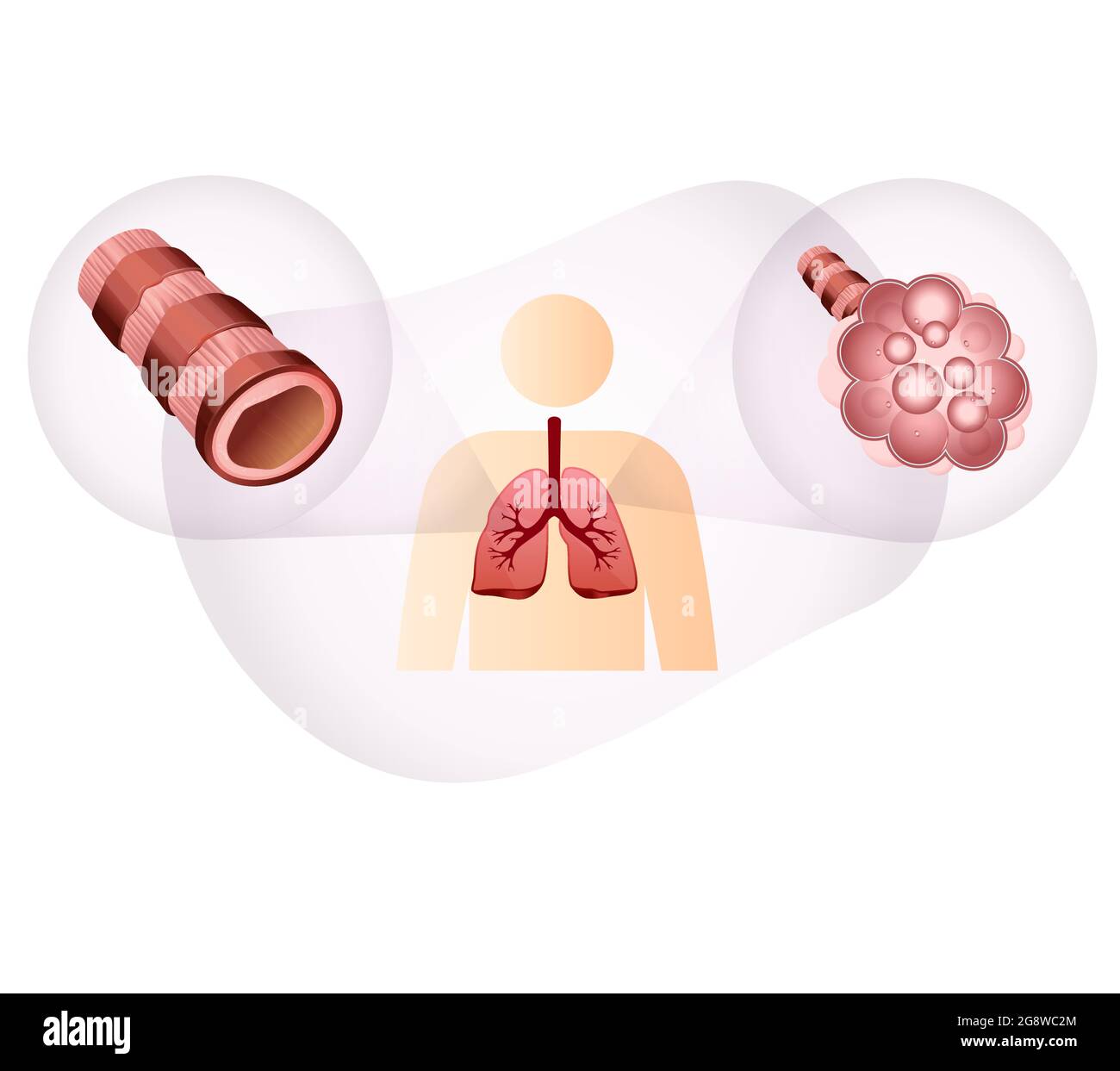 Bronchioli e alveoli nei polmoni umani - Stock Illustration as EPS 10 file Illustrazione Vettoriale