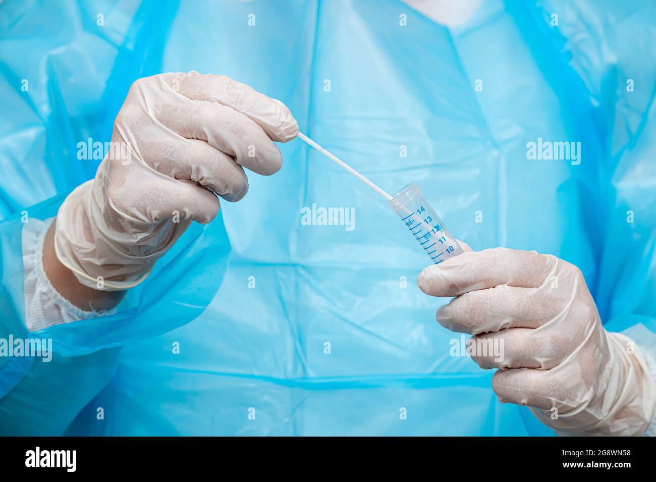 Un operatore medico che contiene un kit di raccolta dei campioni con tampone. Foto Stock