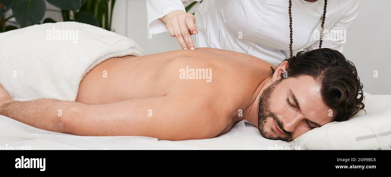 Il paziente maschile con aghi di agopuntura inseriti nella schiena sta ricevendo il trattamento cronico mal di schiena in una clinica di medicina tradizionale cinese con acup Foto Stock