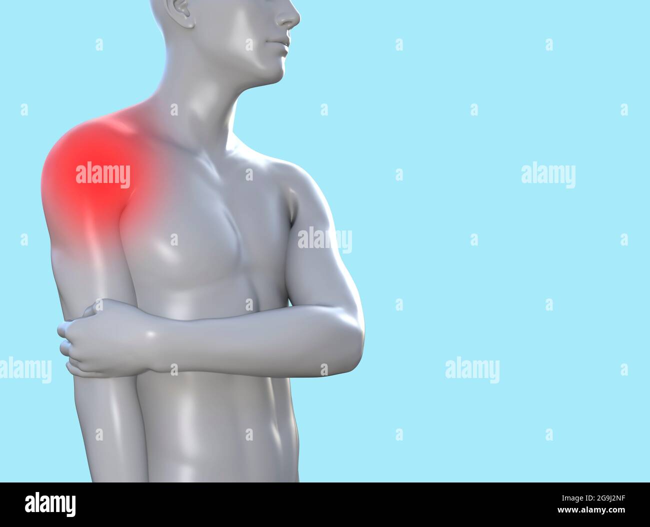 rappresentazione in 3d della figura maschile con area della spalla infiammata rossa su sfondo blu, concetto di clinica traumatologica. Foto Stock