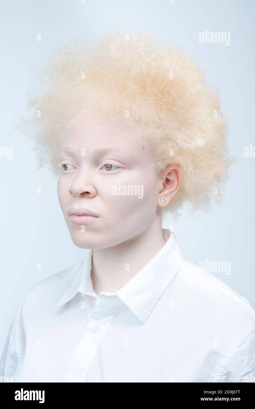 Studio ritratto di donna albina in camicia bianca Foto Stock