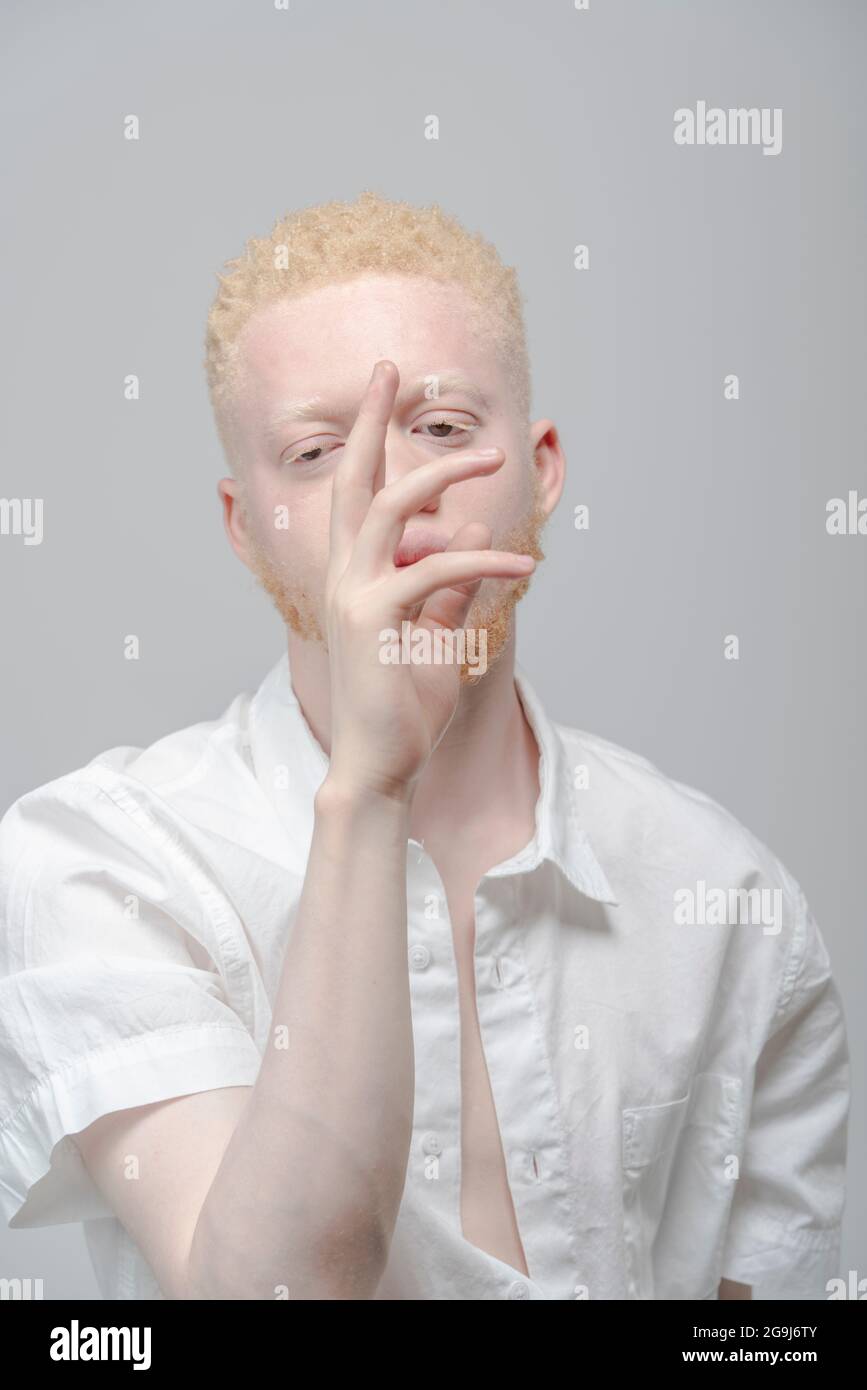 Studio ritratto di albino in camicia bianca Foto Stock