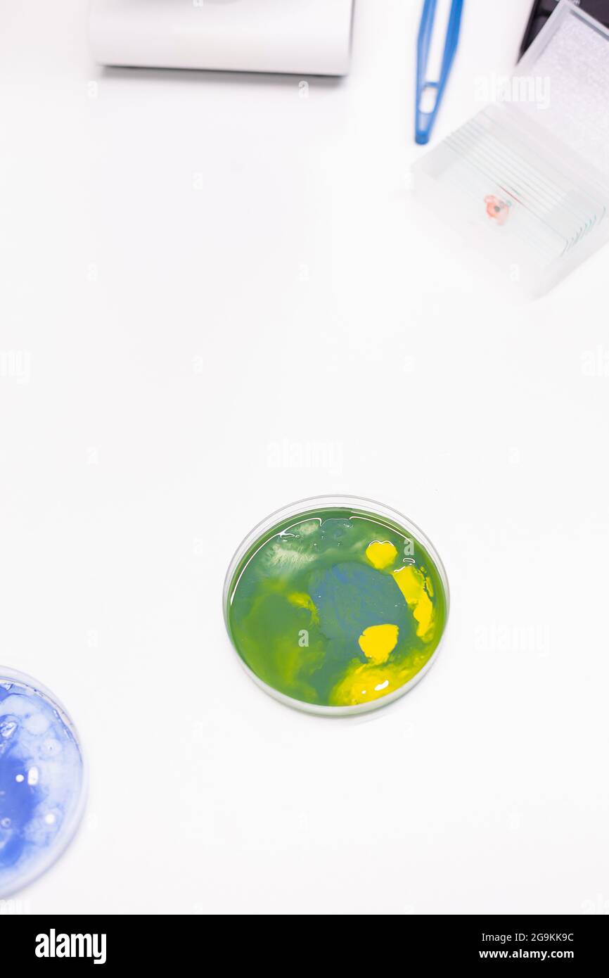 Misto di colonia di batteri in capsula di Petri in piedi sul tavolo in laboratorio biologico scientifico ospedaliero. Campione liquido di microrganismo farmaceutico. Microrganismo medico liquido Foto Stock