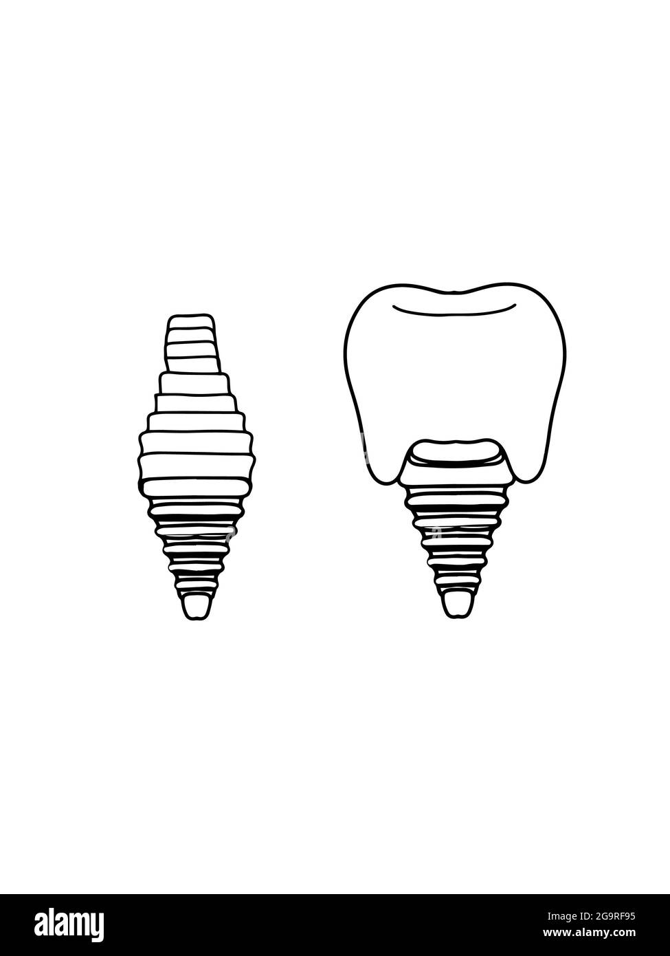 Impianti dentali , illustrazione , icona. Foto Stock