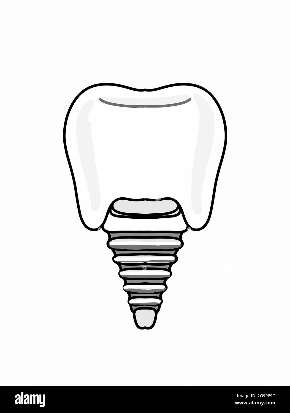 Impianti dentali , illustrazione , icona. Foto Stock