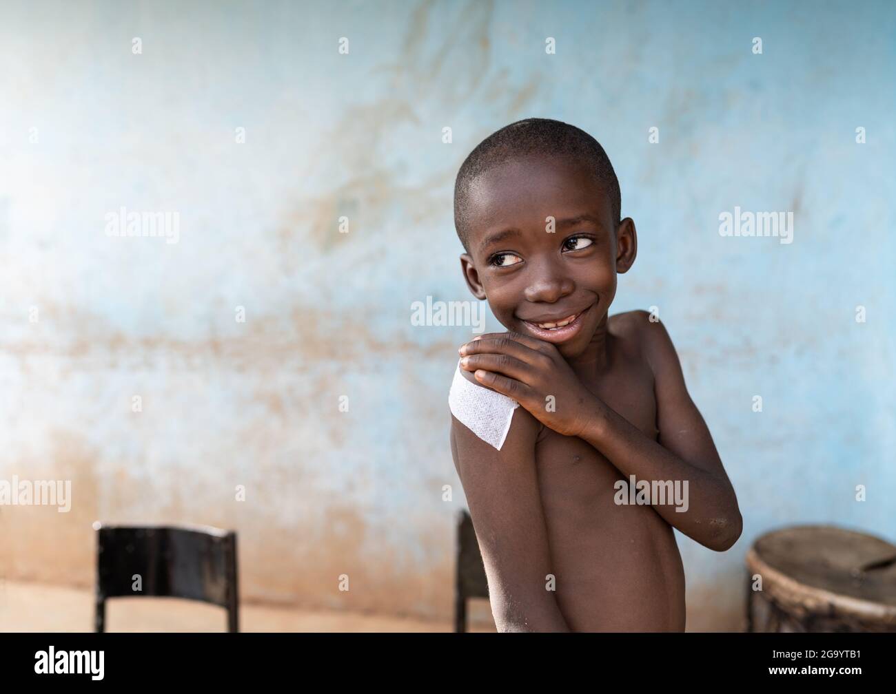 In questa immagine un bambino africano nero appena sorridente alleviato sta mettendo la sua mano sulla sua spalla dove un grande gesso sta coprendo il luogo di un j Foto Stock