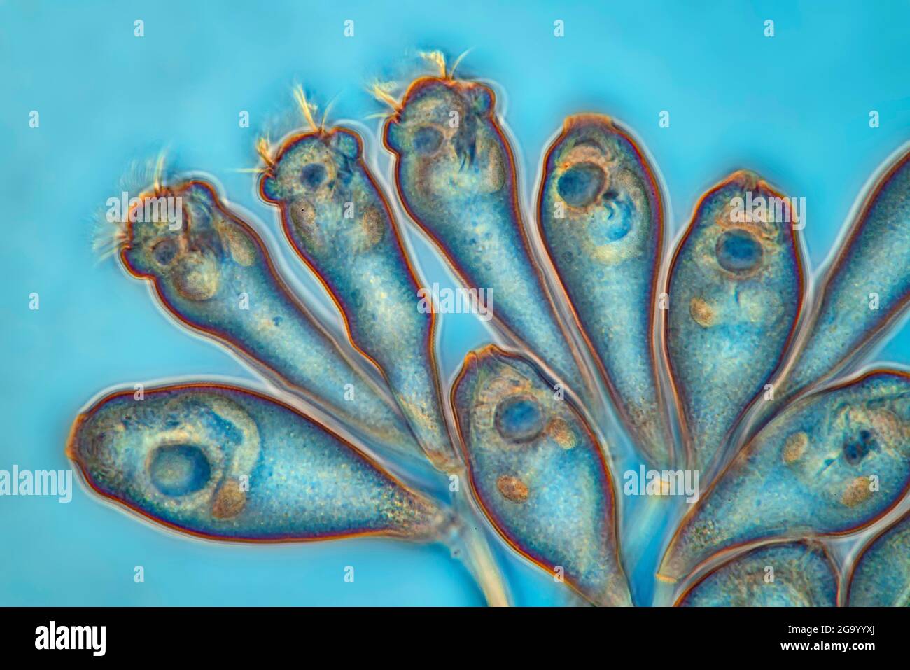 Vorticella (spec. Vorticella), immagine RM a contrasto di fase, ingrandimento x57 correlato a una stampa con larghezza di 10 cm Foto Stock