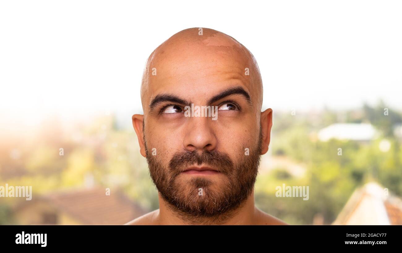 Un uomo caucasico abbronzato con la testa rasata ha un problema con la  pelle sulla parte superiore della testa che si stacca a causa di scottature  solari. Sta guardando verso l'alto e