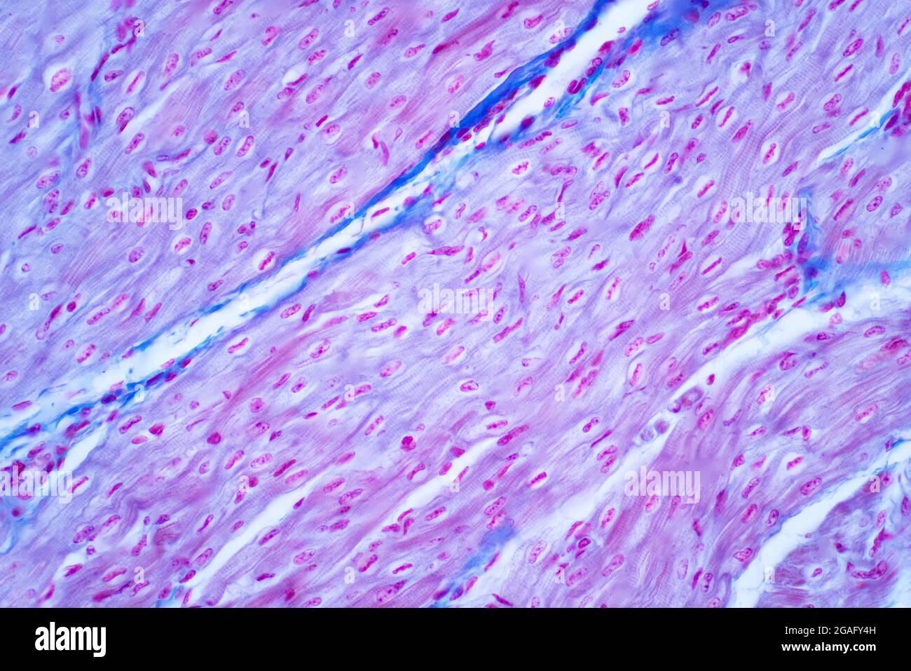 Muscolo cardiaco umano, micrografia leggera Foto Stock