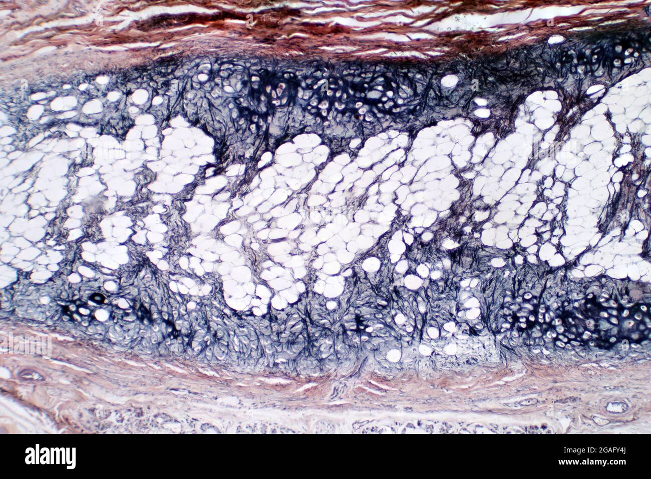 Cartilagine umana e osso, micrografia leggera Foto Stock