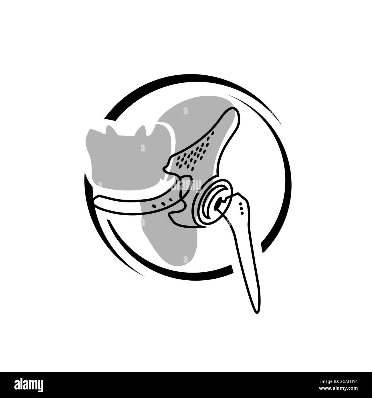marchio creativo ortopedico impianti di osso disegno del logo vettore del simbolo medico eps.10 icona illustrazione Illustrazione Vettoriale
