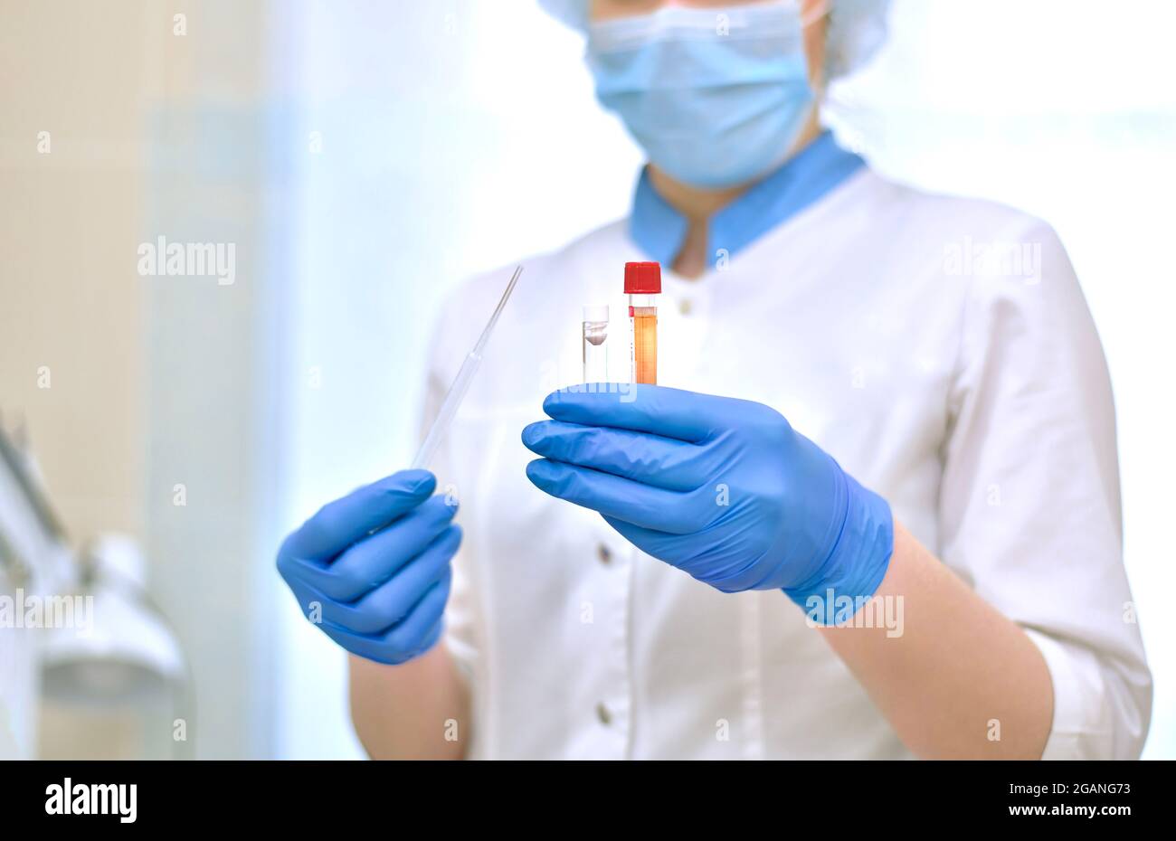 Il processo di separazione del siero di sangue dal fibrinogeno in laboratorio. Foto Stock